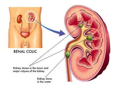 Nephrocare Division